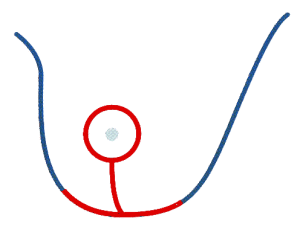 inverted T incision