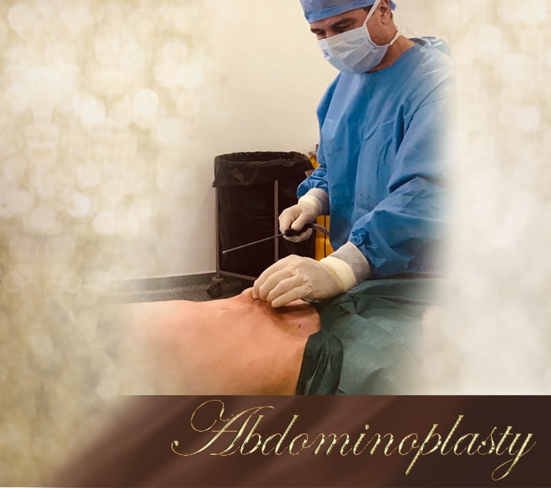 Abdominoplasty - mobile Abdominoplasty