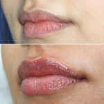Lips0