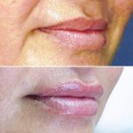 Lips11