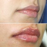 Lips13