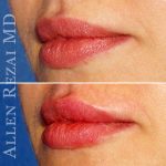 Lips14