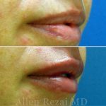 Lips16