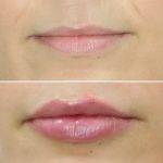 Lips17