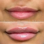 Lips18