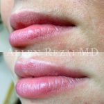 Lips21