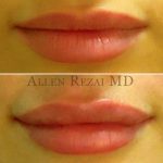 Lips29