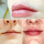 Lips32
