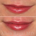 Lips8