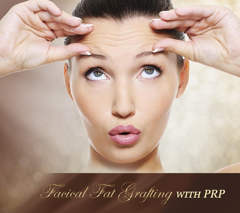 facial fat grafting with prp - mobile facial fat grafting with prp
