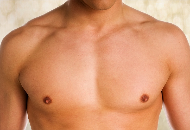 gynecomastia surgery London