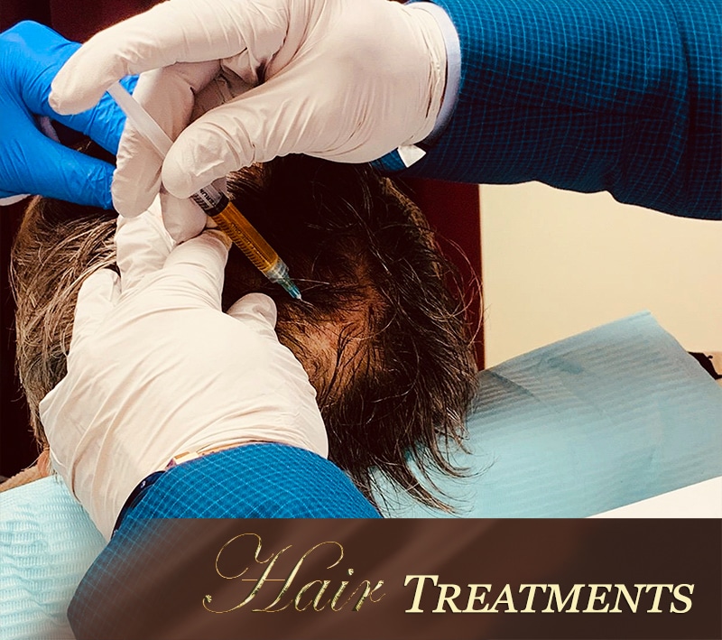 hairloss - mobile PRP therapy for hair loss