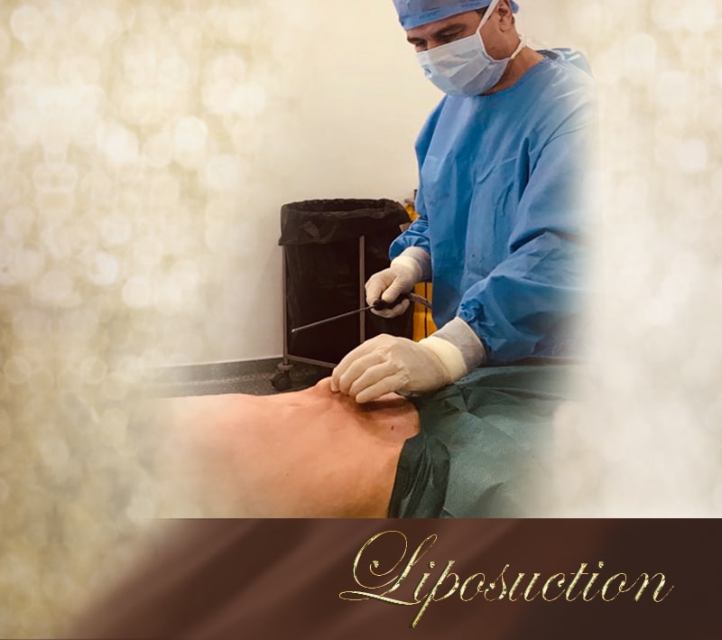 liposuction - mobile