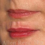 lips31