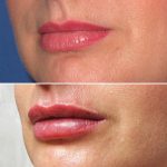 Lips33