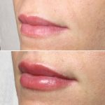 Lips34