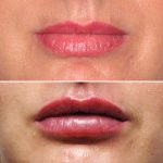 Lips38