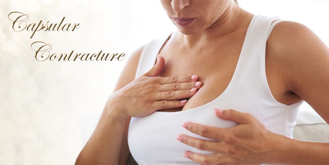 capsular-contracture-London