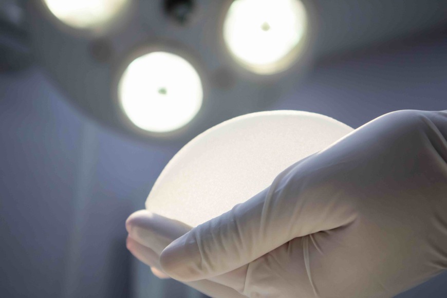 what is capsular contracture what is capsular contracture