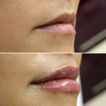 lips-july2