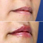 lips-july3