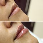 lips-july4