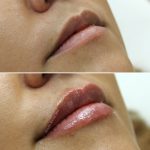 lips-july5