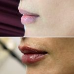 lips-july7