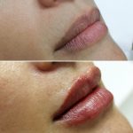 lips-july8