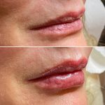 Lips-august1