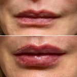 Lips-august2
