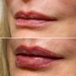 Lips-august3