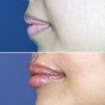 Lips-august4