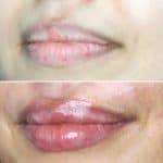 Lips-august5