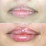 Lips-august6