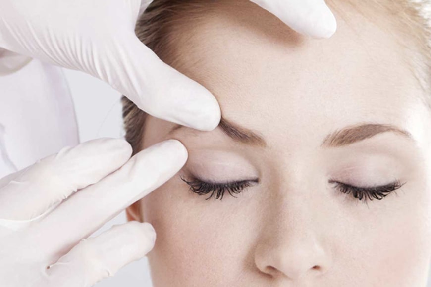 Eyelid-surgery-image2-min