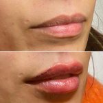 lips-march1