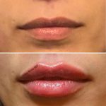 lips-march2