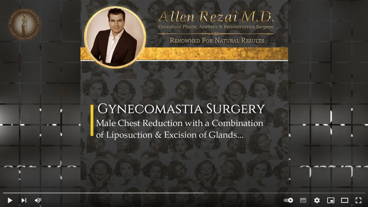 gynecomastia